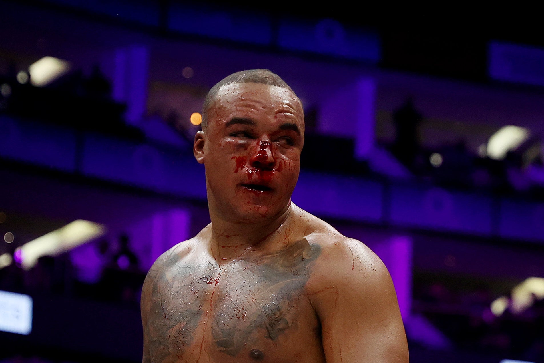 Wardley’s face was left a bloody mess, but he exited the O2 with his belts