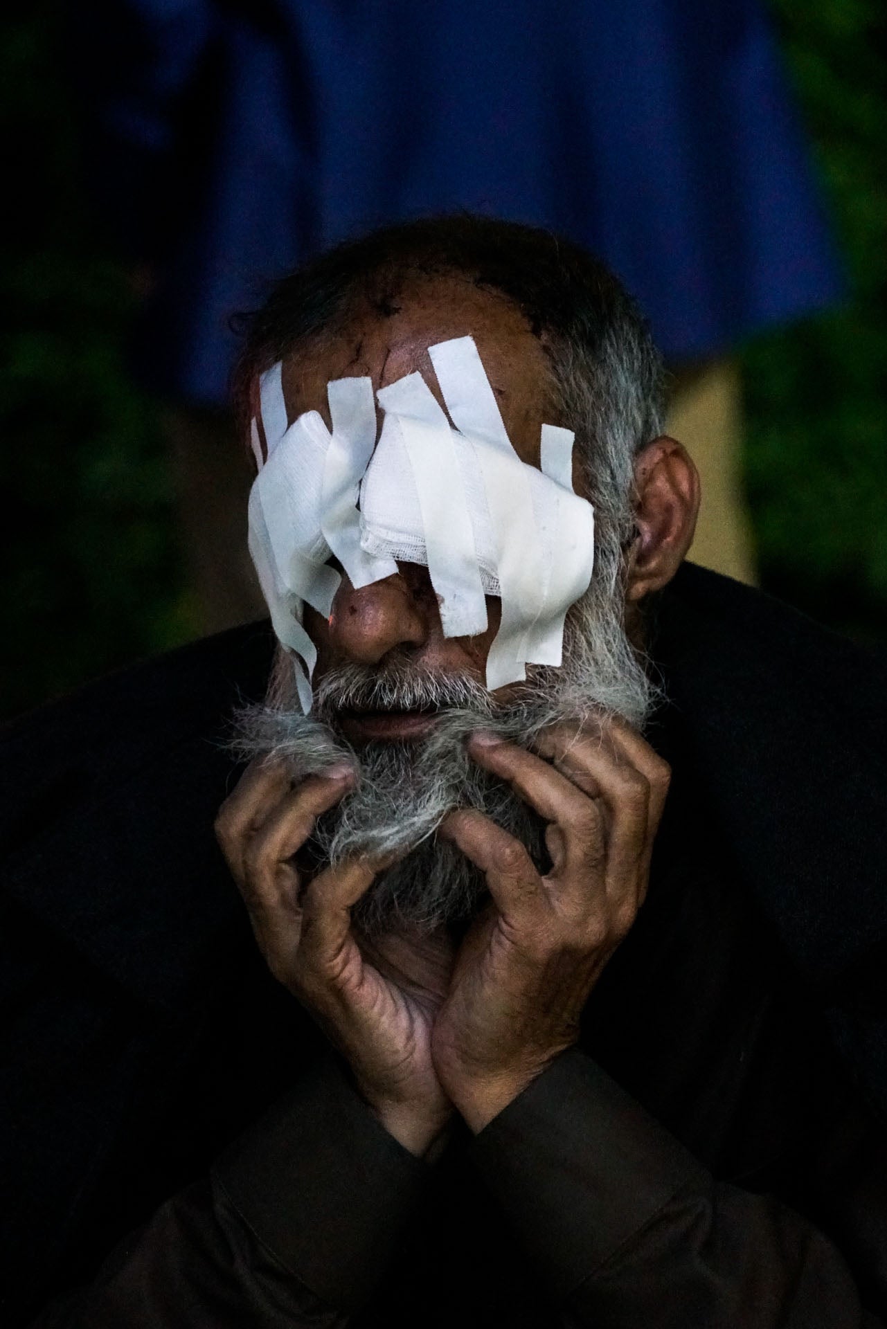 Adnan Thanon Younis was blinded by an exploding shell in Mosul