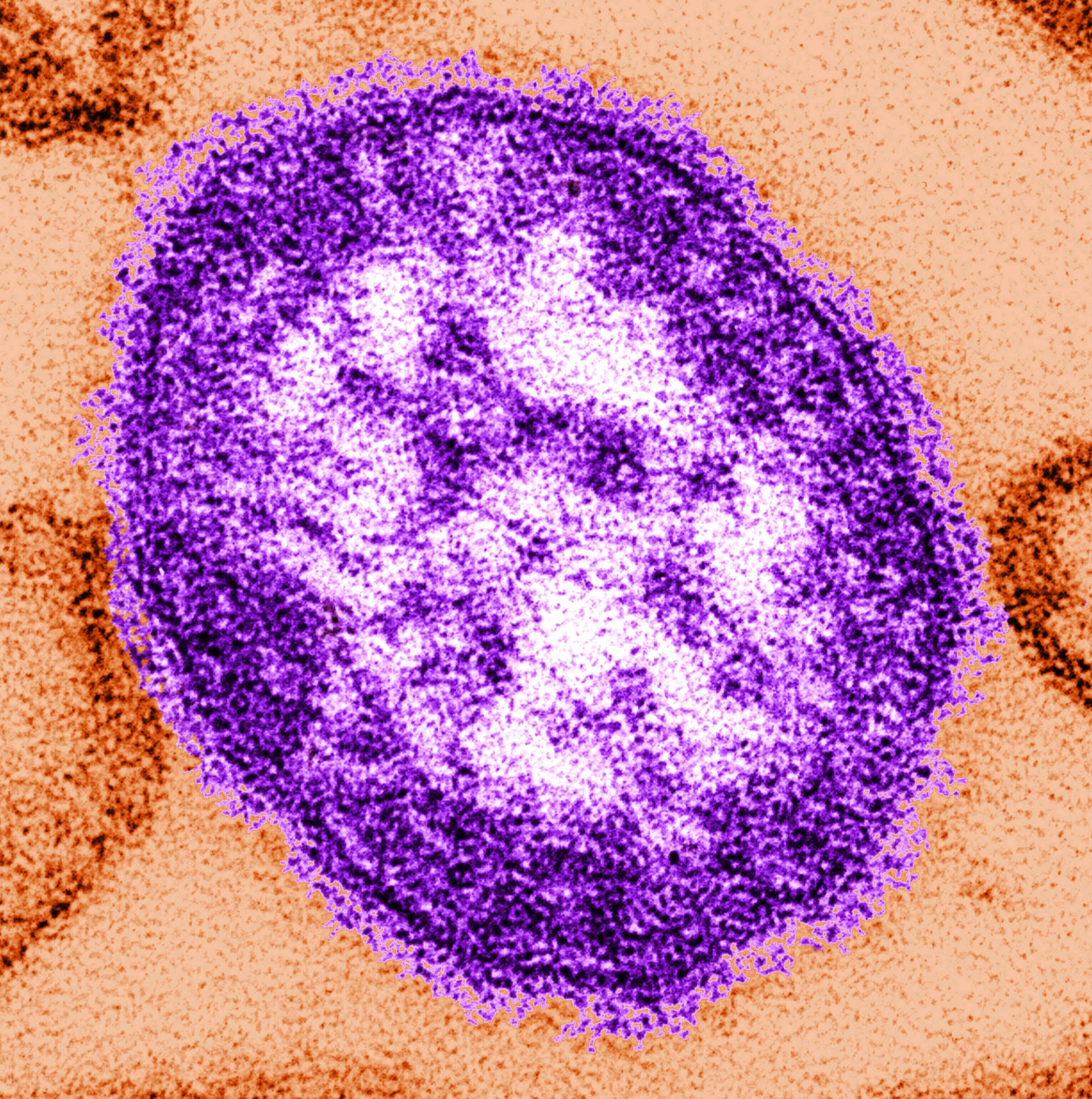 An electron microscope image of a measles virus particle