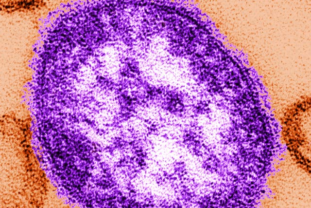 <p>An electron microscope image of a measles virus particle</p>