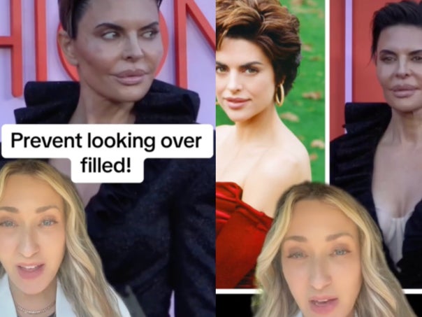 <p>TikToker comments on Lisa Rinna’s facial fillers </p>