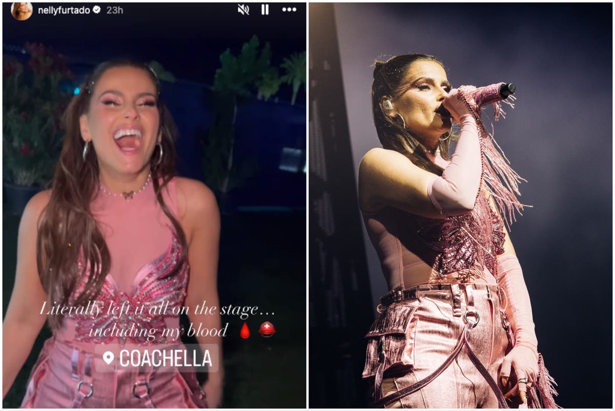 Nelly Furtado shares injury photo after fall during Coachella Festival performance