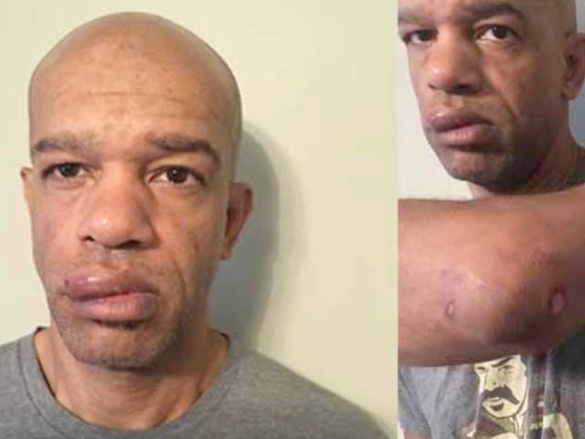 <p>Former St Louis police officer Luther Hall pictured here with injuries he sustained when his colleagues beat him during a protest in 2017</p>