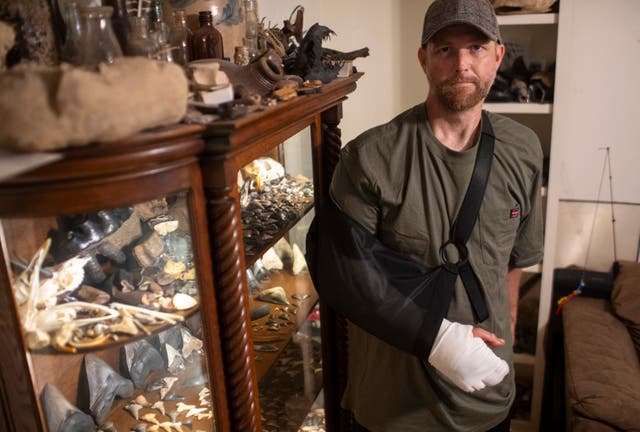 <p>Will Georgitis stands with a collection of fossils he found over the years, was recently attacked by an alligator while out scuba diving in the Cooper River looking for megalodon teeth and other unique items</p>