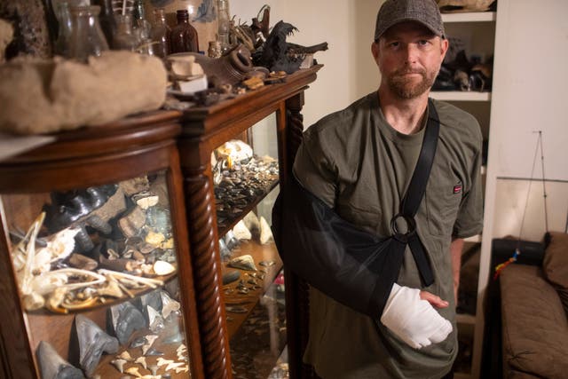 <p>Will Georgitis stands with a collection of fossils he found over the years, was recently attacked by an alligator while out scuba diving in the Cooper River looking for megalodon teeth and other unique items</p>