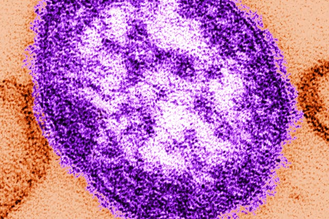 Measles Case West Virginia