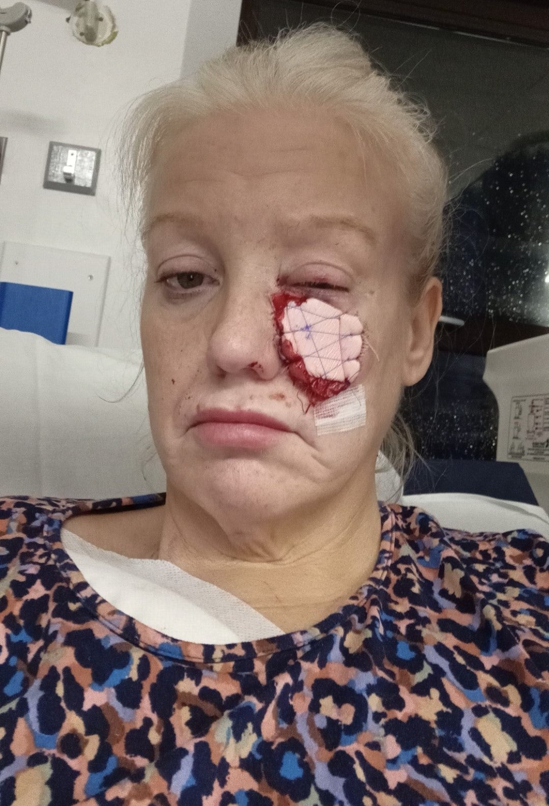 Kelly woke up in hospital after her operation with a bandage stitched to her face