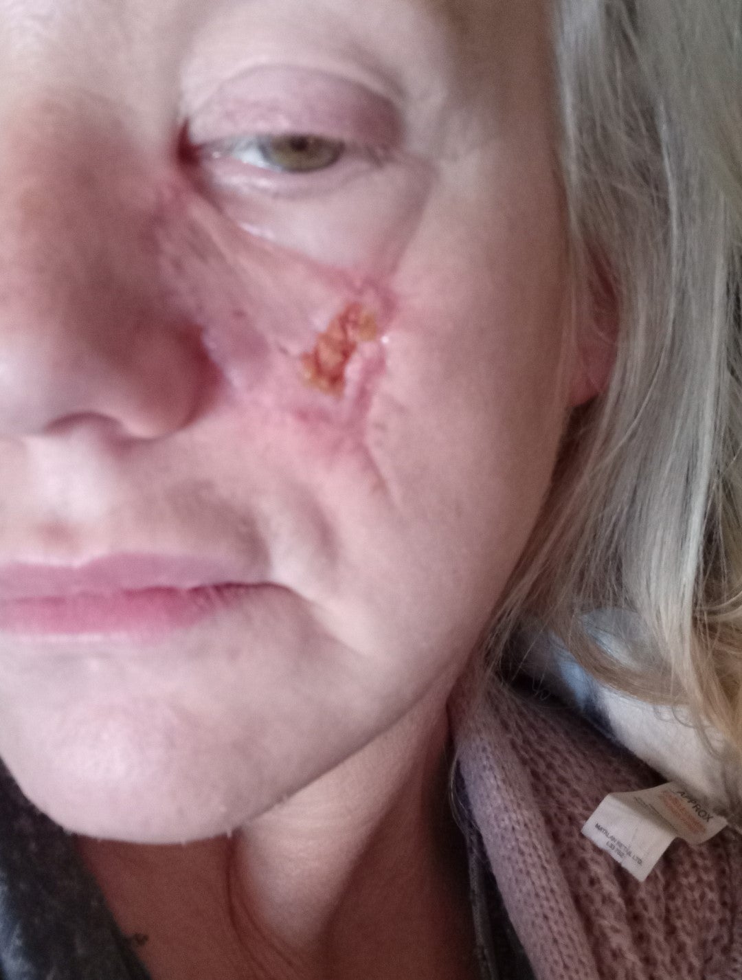 Kelly her self-esteem has been ‘absolutely destroyed’ by the scar the dog left on her face (Collect/PA Real Life)