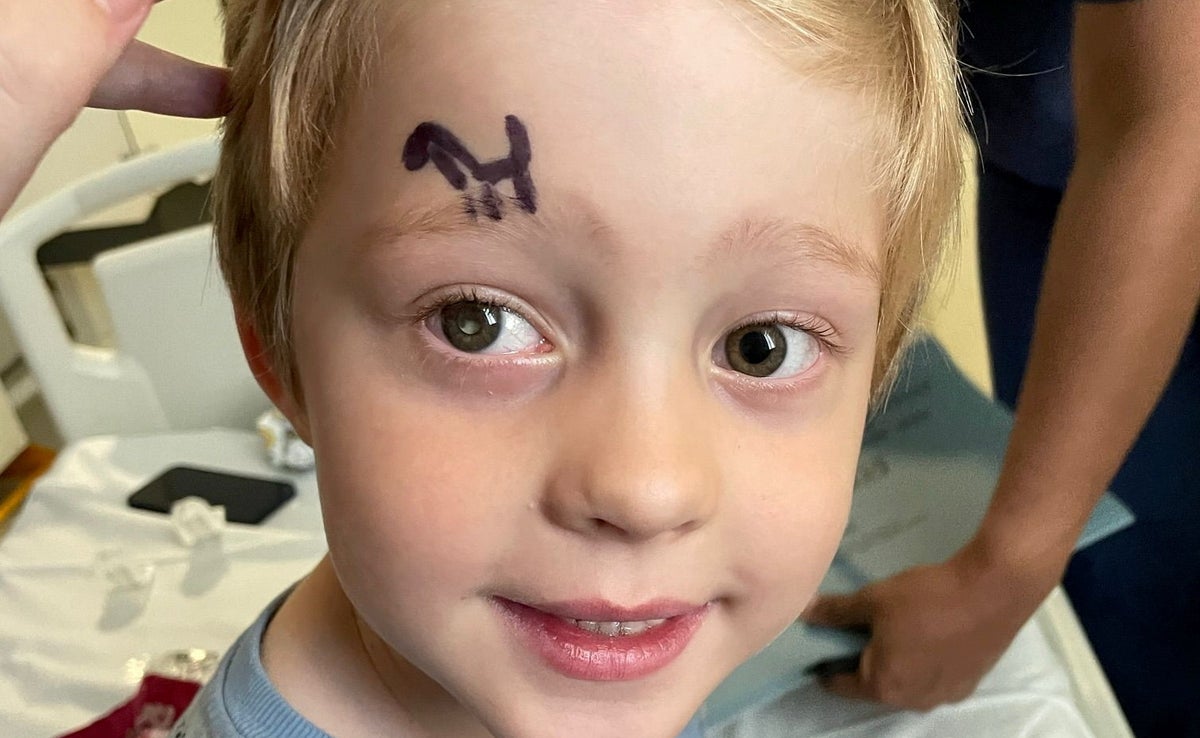 Arlo’s mother saw something in his eye. She never thought it could be cancer
