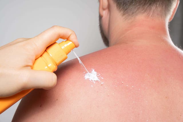 Sun exposure is a big factor in melanoma risk (Alamy/PA)