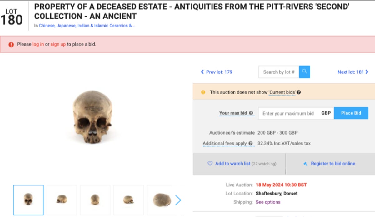 ‘Profiting from selling African body parts’:  Auction house slammed over sale of Black human remains