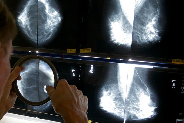 Mammograms-Explainer