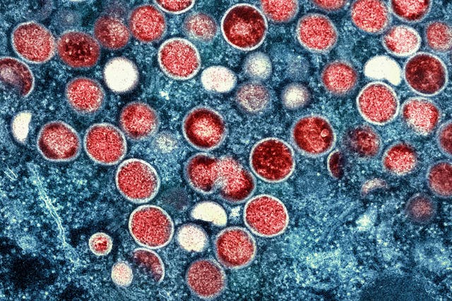 <p>This image provided by the National Institute of Allergy and Infectious Diseases (NIAID) shows a colorized transmission electron micrograph of monkeypox particles (red) found within an infected cell (blue)</p>