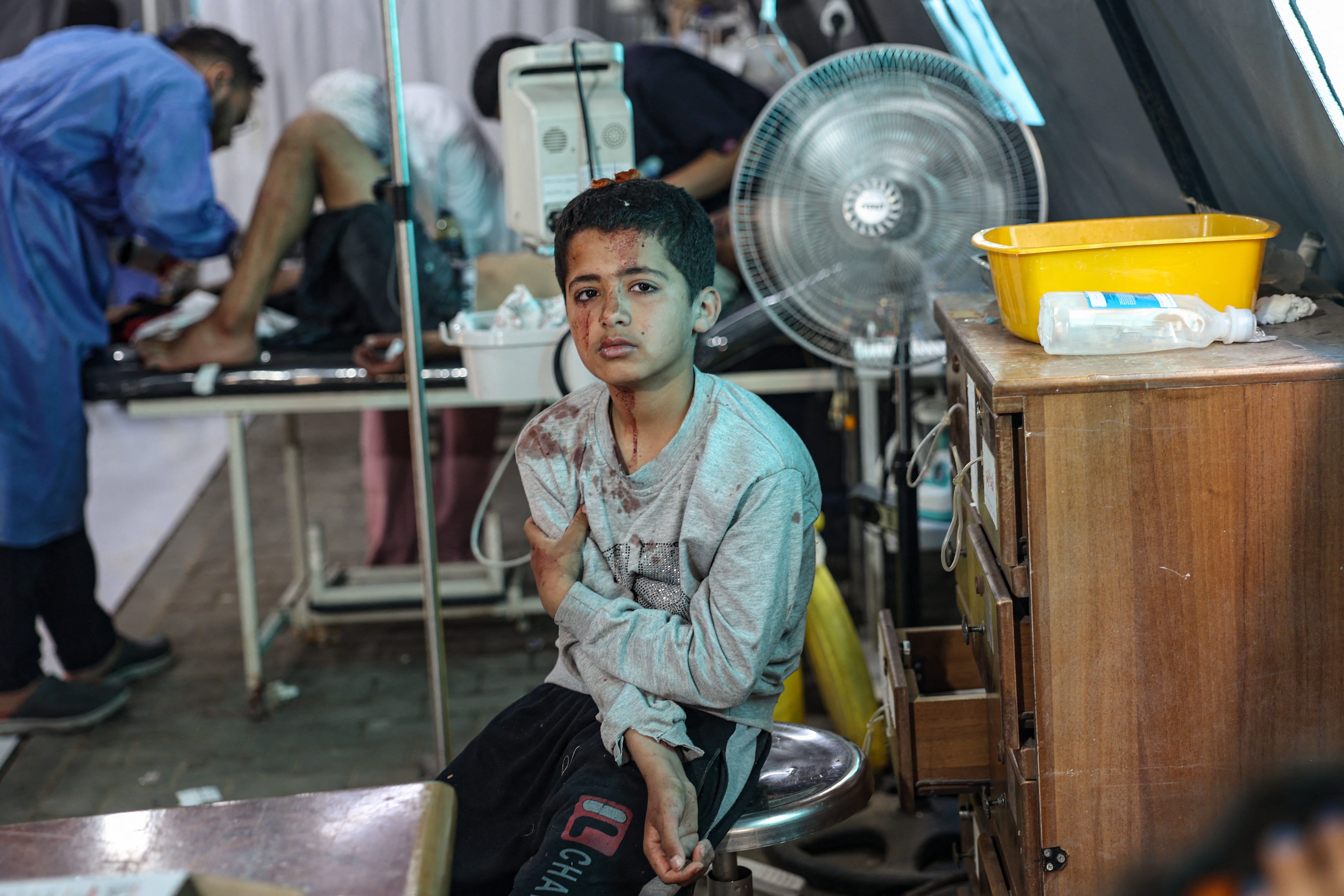 An injured Palestinian boy awaits treatment at the Kuwaiti hospital following Israeli strikes in Rafah in the southern Gaza Strip on 7 May 2024, amid the ongoing conflict between Israel and the Palestinian militant group Hamas