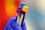 NHS push to stamp out ‘silent killer’ with at-home testing