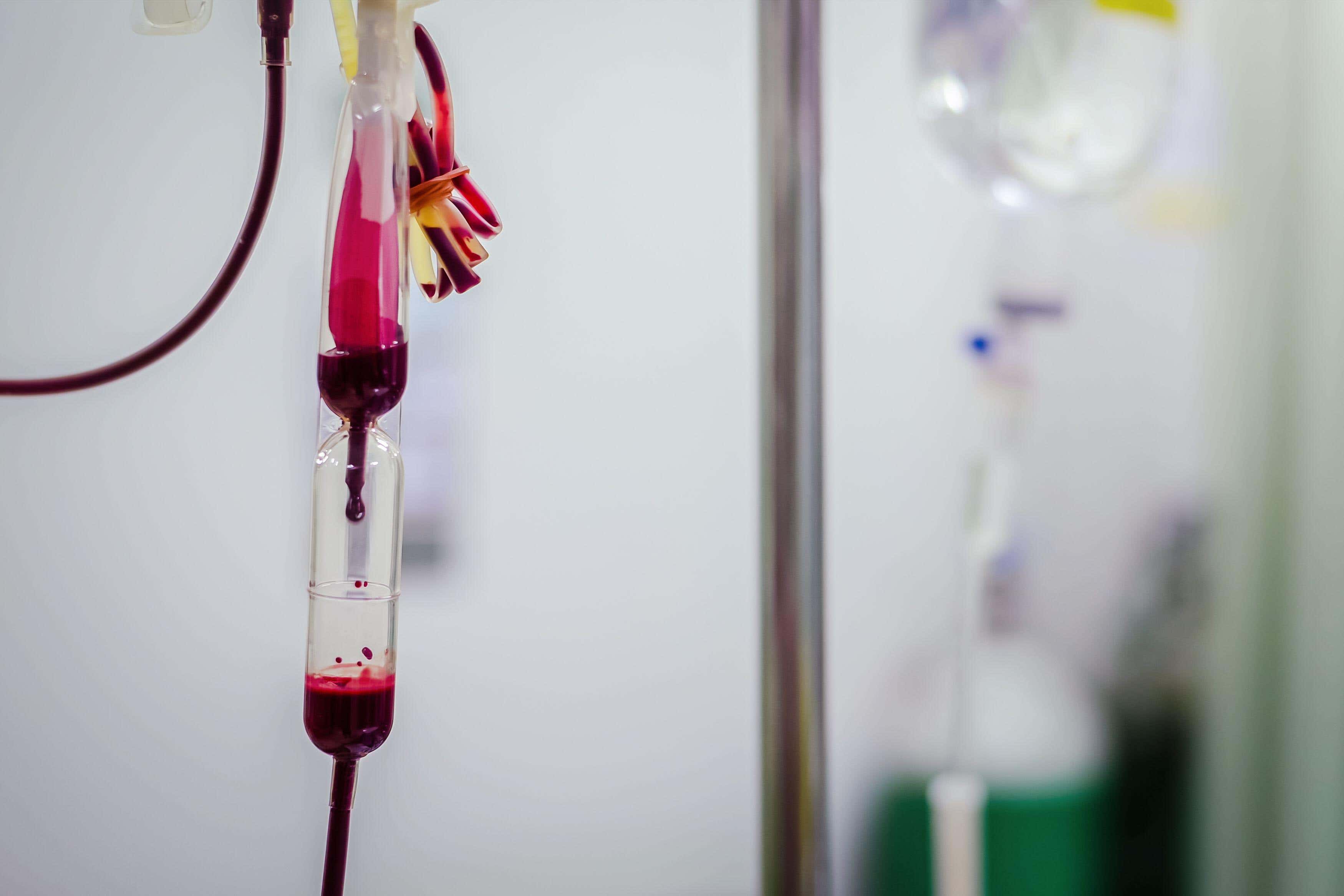 Anyone who had a blood transfusion before 1991 should be checked for hepatitis C, a charity has said (Alamy/PA)