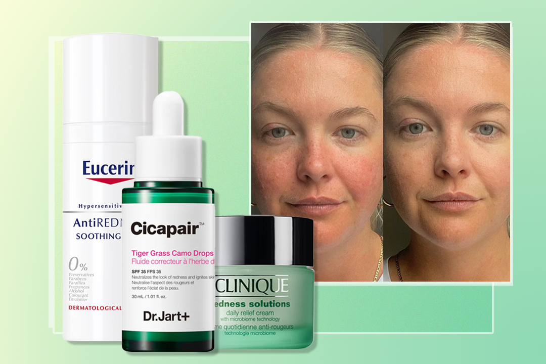 Two doctors share their tips for managing redness-prone skin