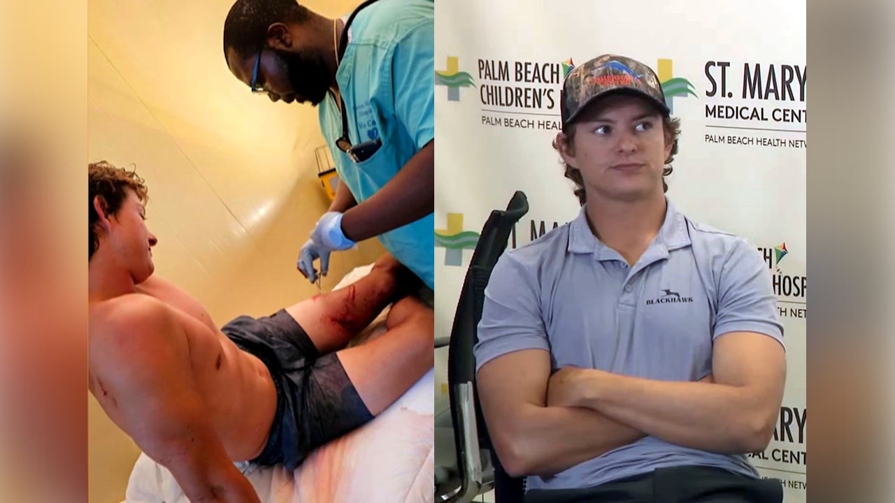 Marlin Wakeman, 24, seen having treatment (left) after being attacked by two sharks in the Bahamas