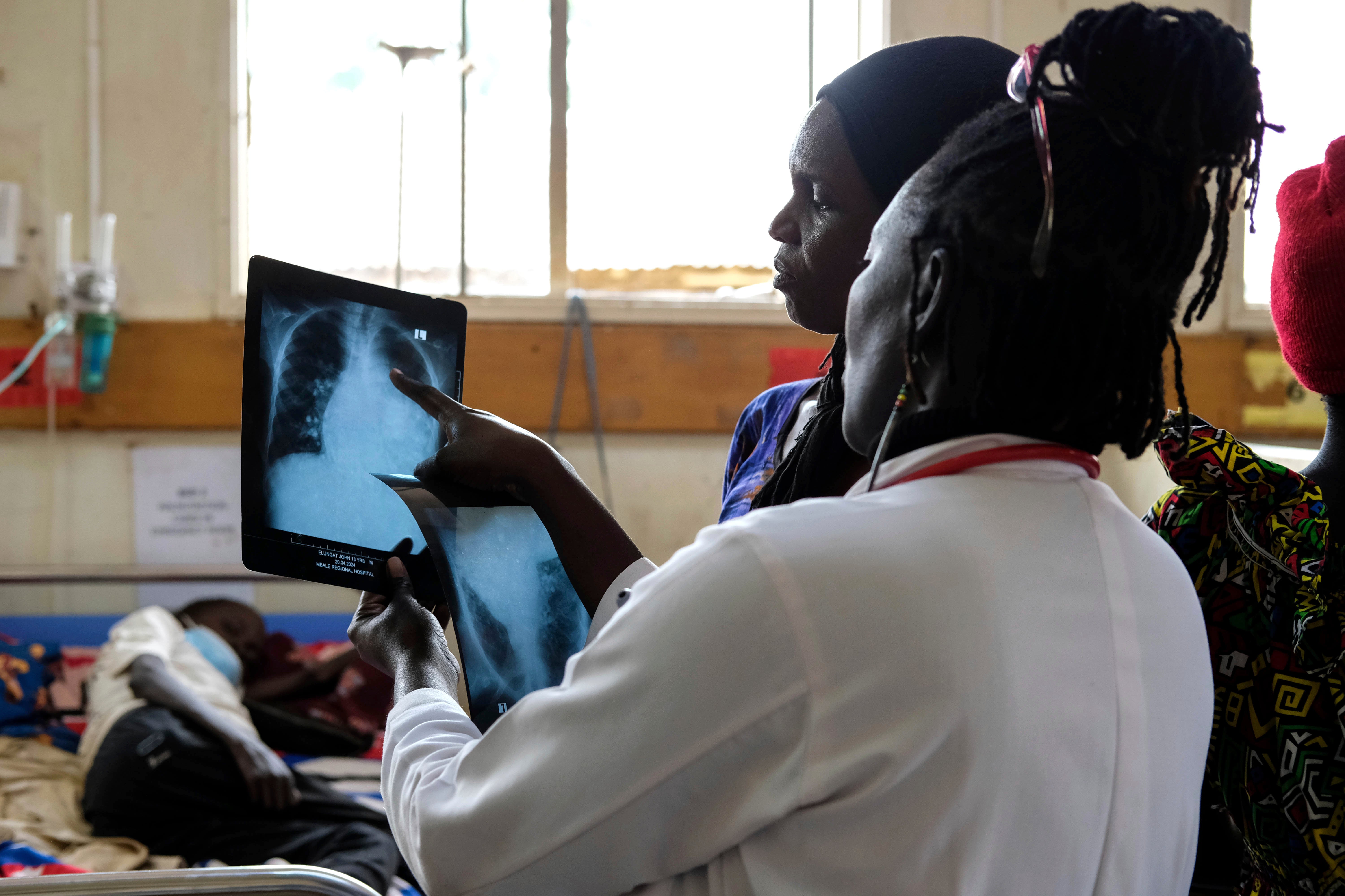 Julian Abeso looks at a sickle cell patient’s x-ray image at the Mbale Regional Referral Hospital, Uganda