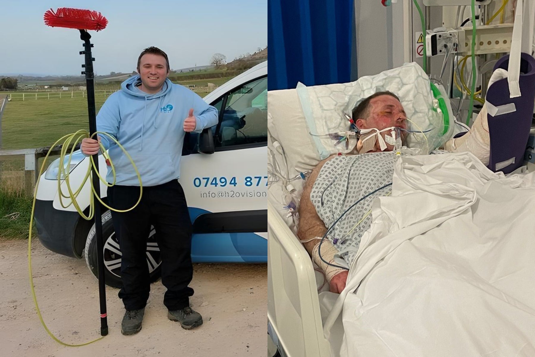 Jason Knight, 34, from Westbury, Wiltshire, survived a 33,000-volt electric shock which left doctors no choice but to amputate his arm (Collect/PA Real Life)