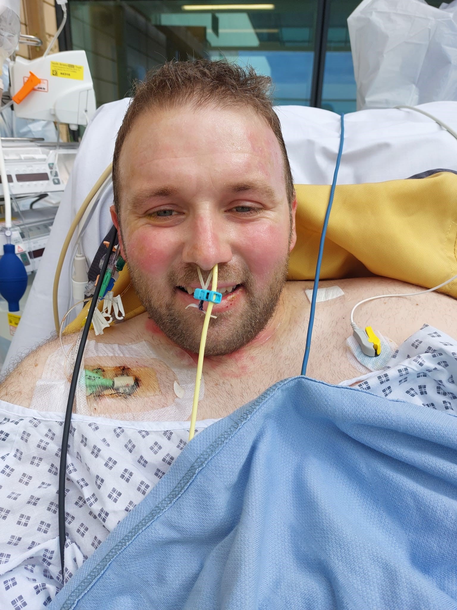 Jason has undergone 17 surgeries, including several to remove five of his toes and a ‘significant amount' of dead tissue