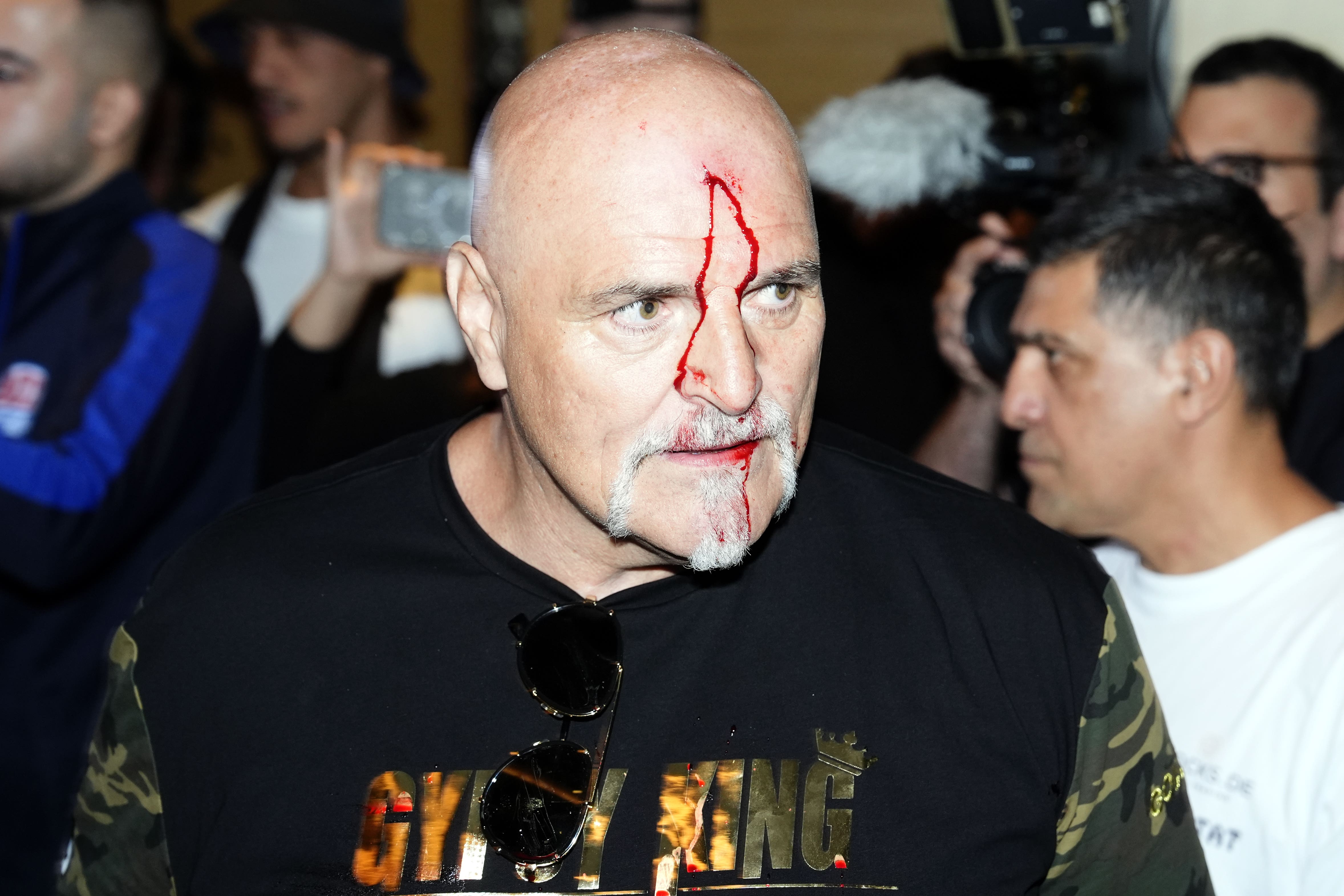 John Fury sustained a cut after headbutting one of Usyk’s teammates (Nick Potts/PA)