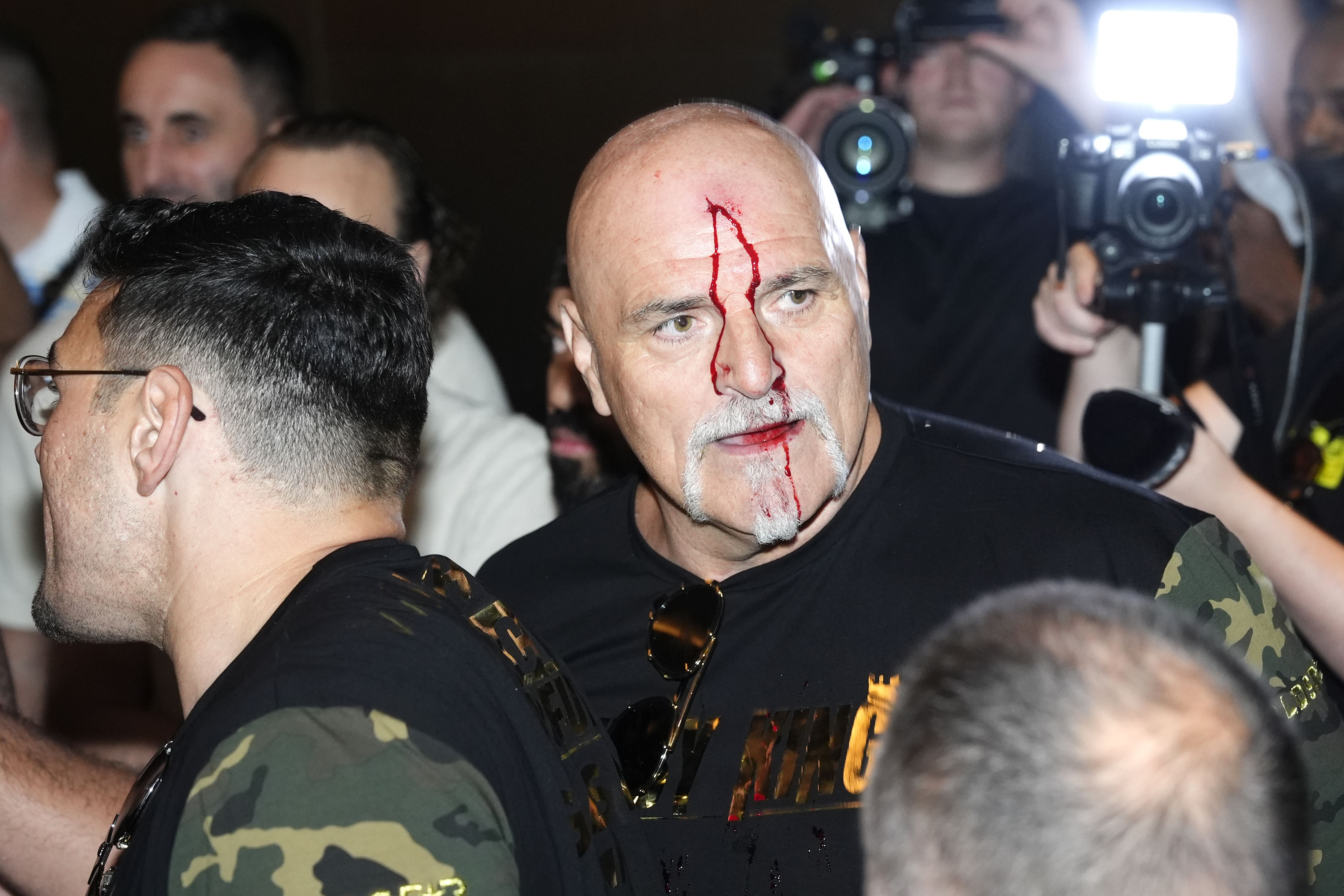 John Fury sustained a cut after headbutting one of Oleksandr Usyk’s teammates