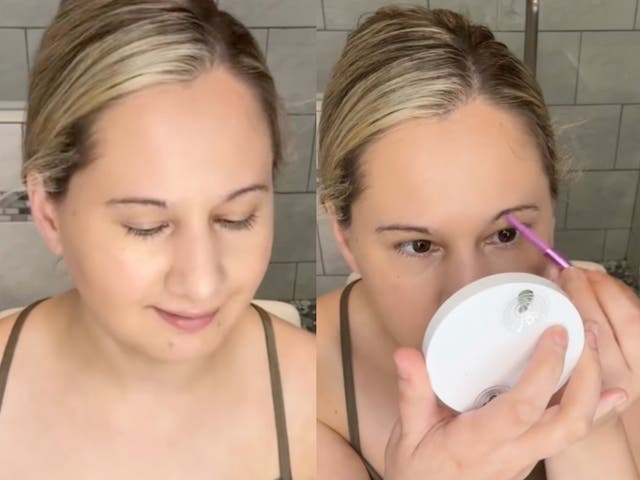 <p>Gypsy Rose Blanchard opens up about her nose job recovery </p>