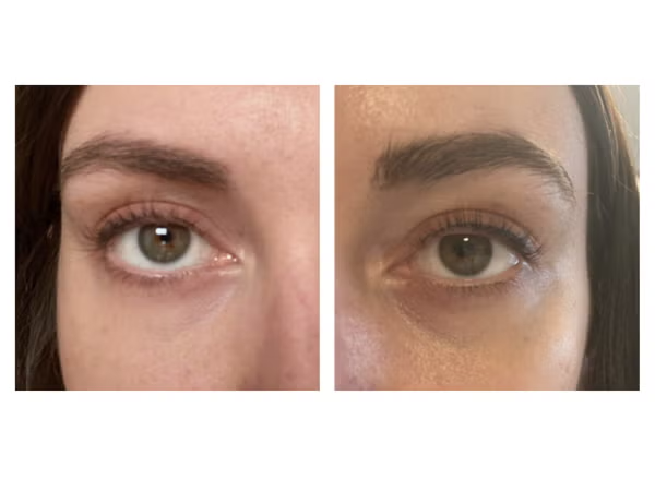 My lashes before and after two months