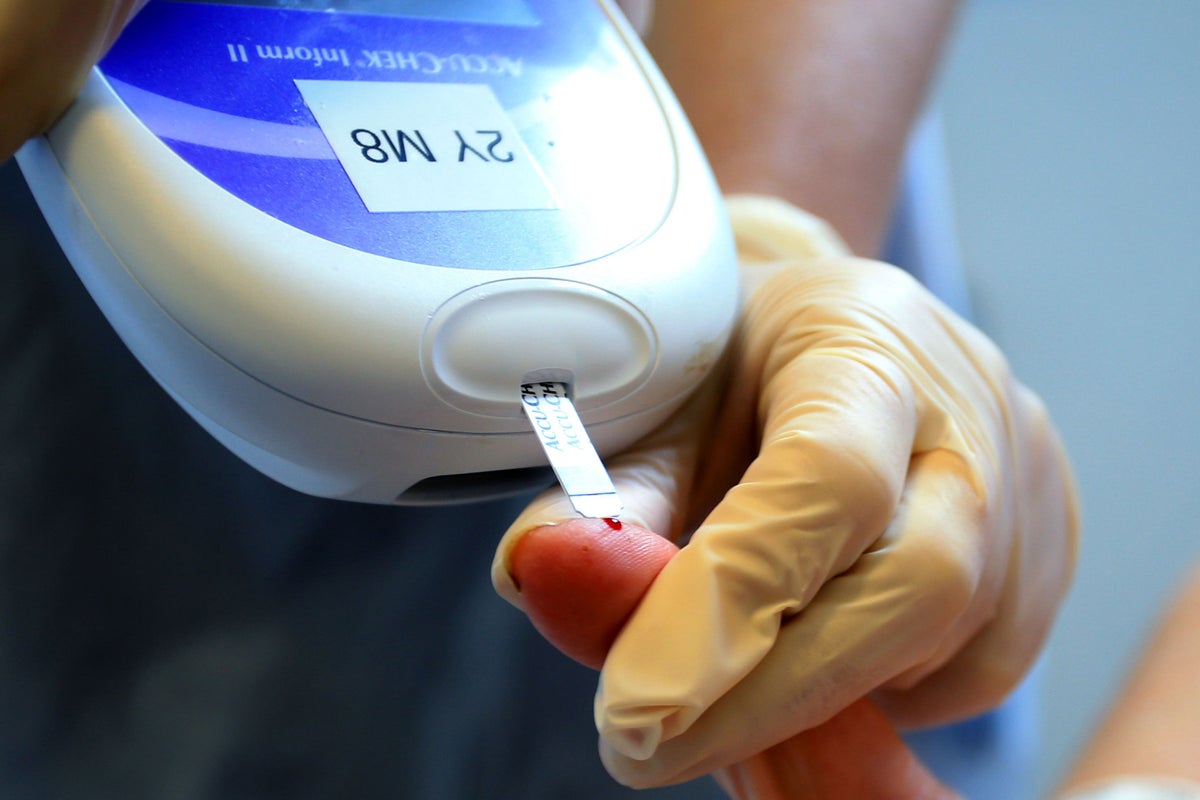 Type 5 diabetes is a newly recognised disease – here’s how it compares