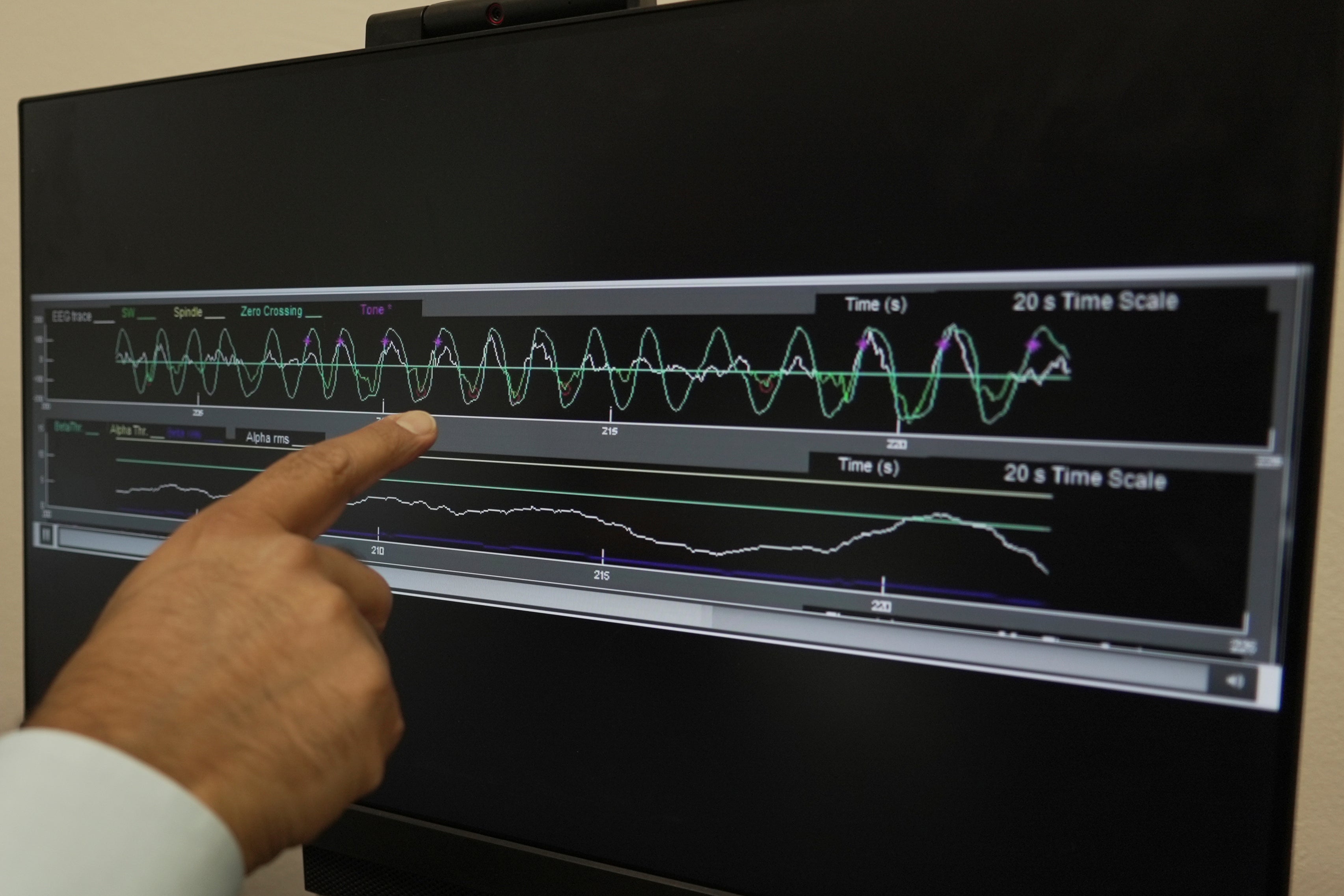 Dr. Roneil Malkani points to a recording of pink noise being played at brief intervals to enhance slow brain waves