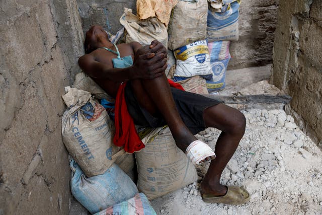 <p>A Kush user reacts after receiving treatment at Sierra Leone’s Youth Development and Child Link </p>