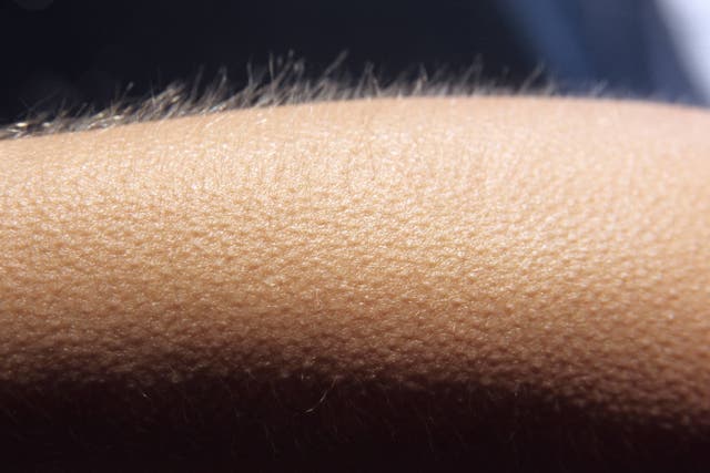 Goosebumps (Alamy/PA)