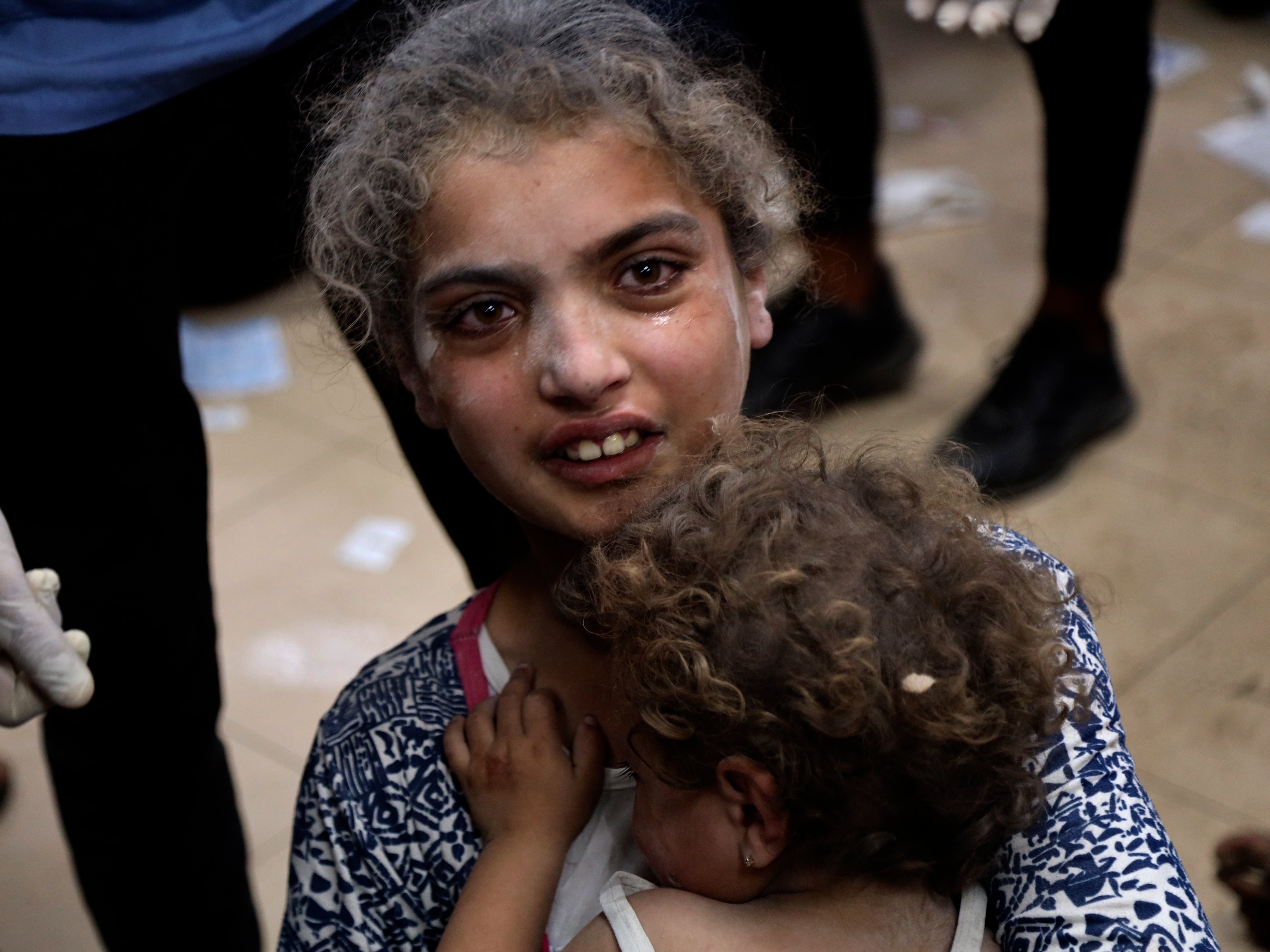 Palestinian children wounded in Israeli bombardment in Bureij refugee camp