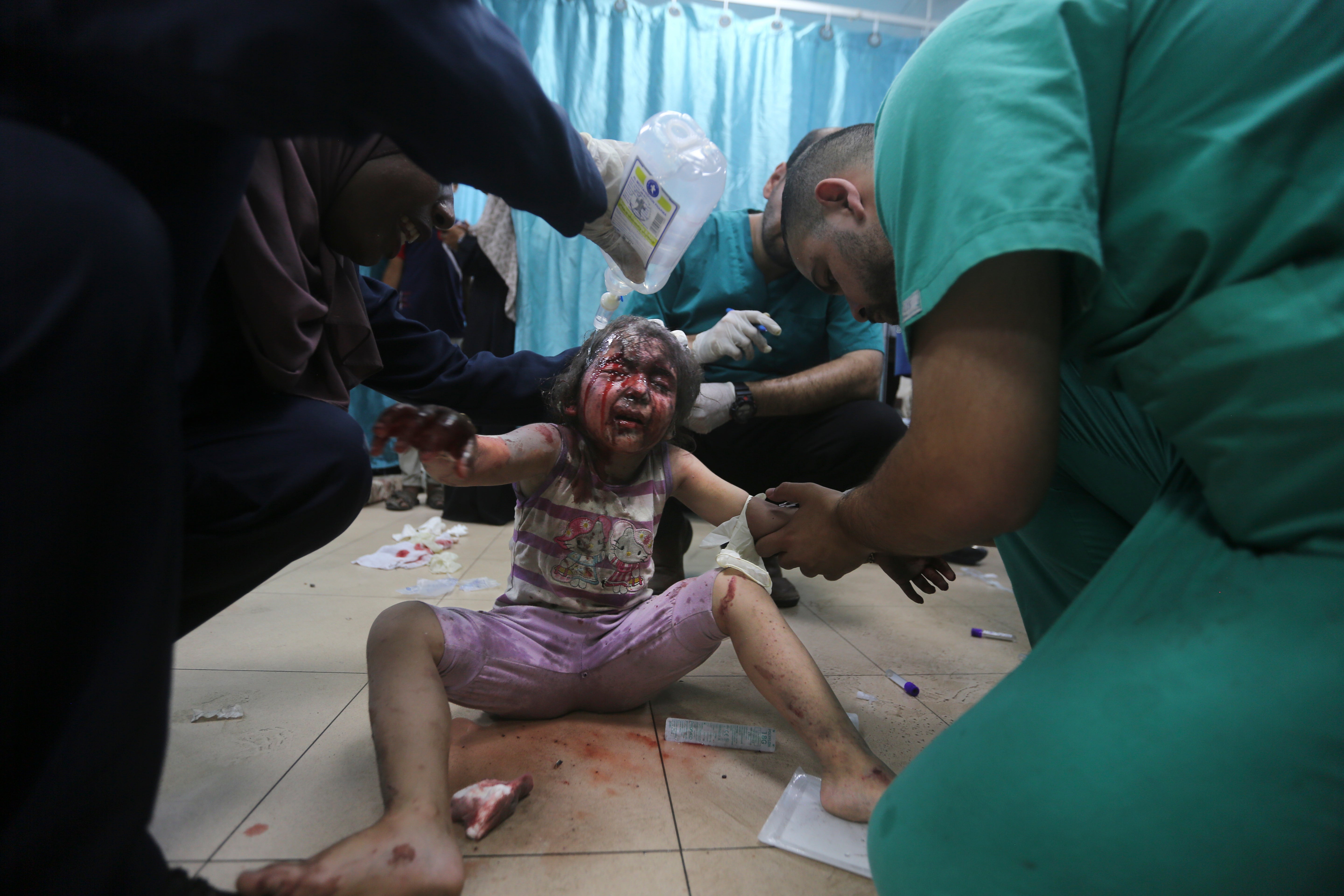A wounded Palestinian child is treated at Al-Aqsa Hospital in Gaza