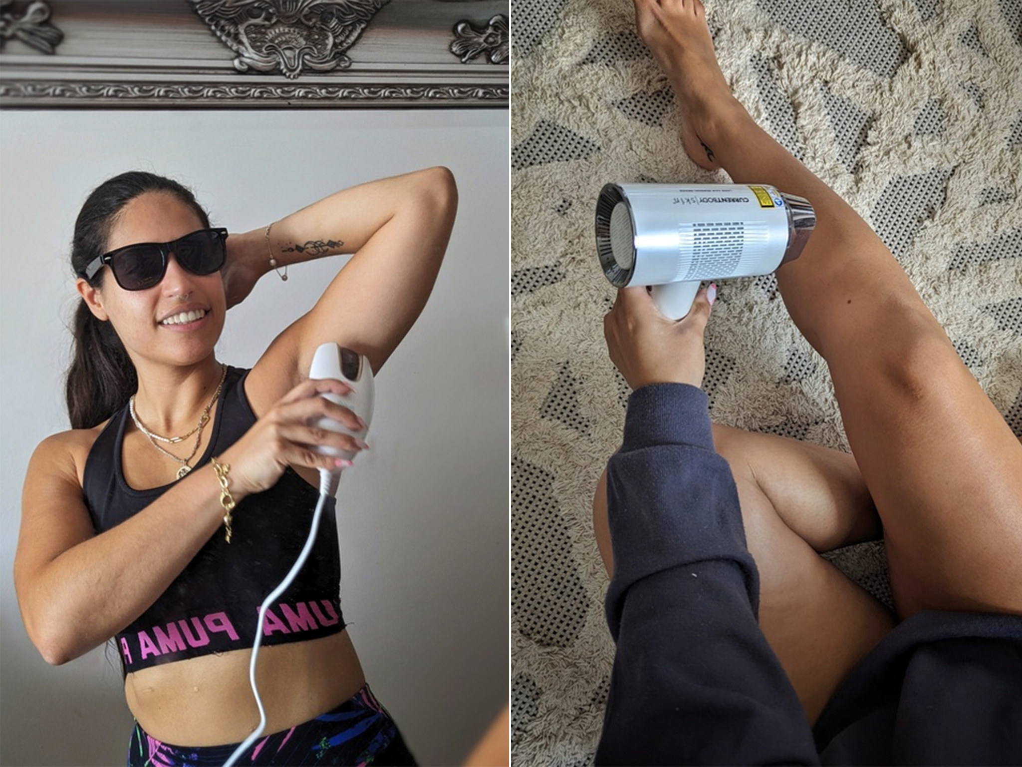 Our tester in action with the laser hair removal devices