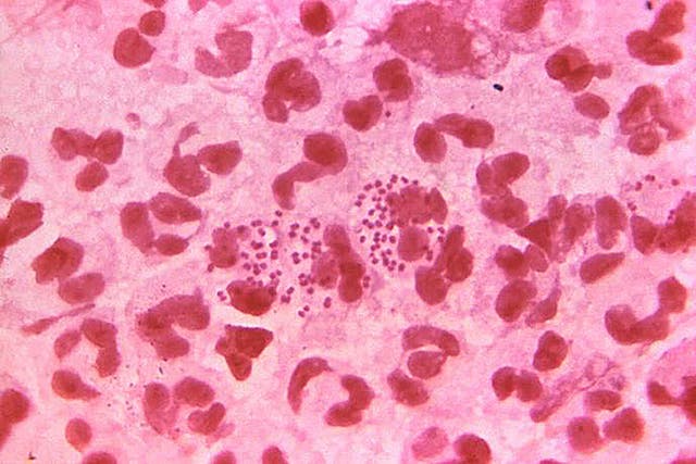 <p>Authors note that resistant strains are prevalent in several Asian countries, and have been increasingly confirmed across Europe</p>