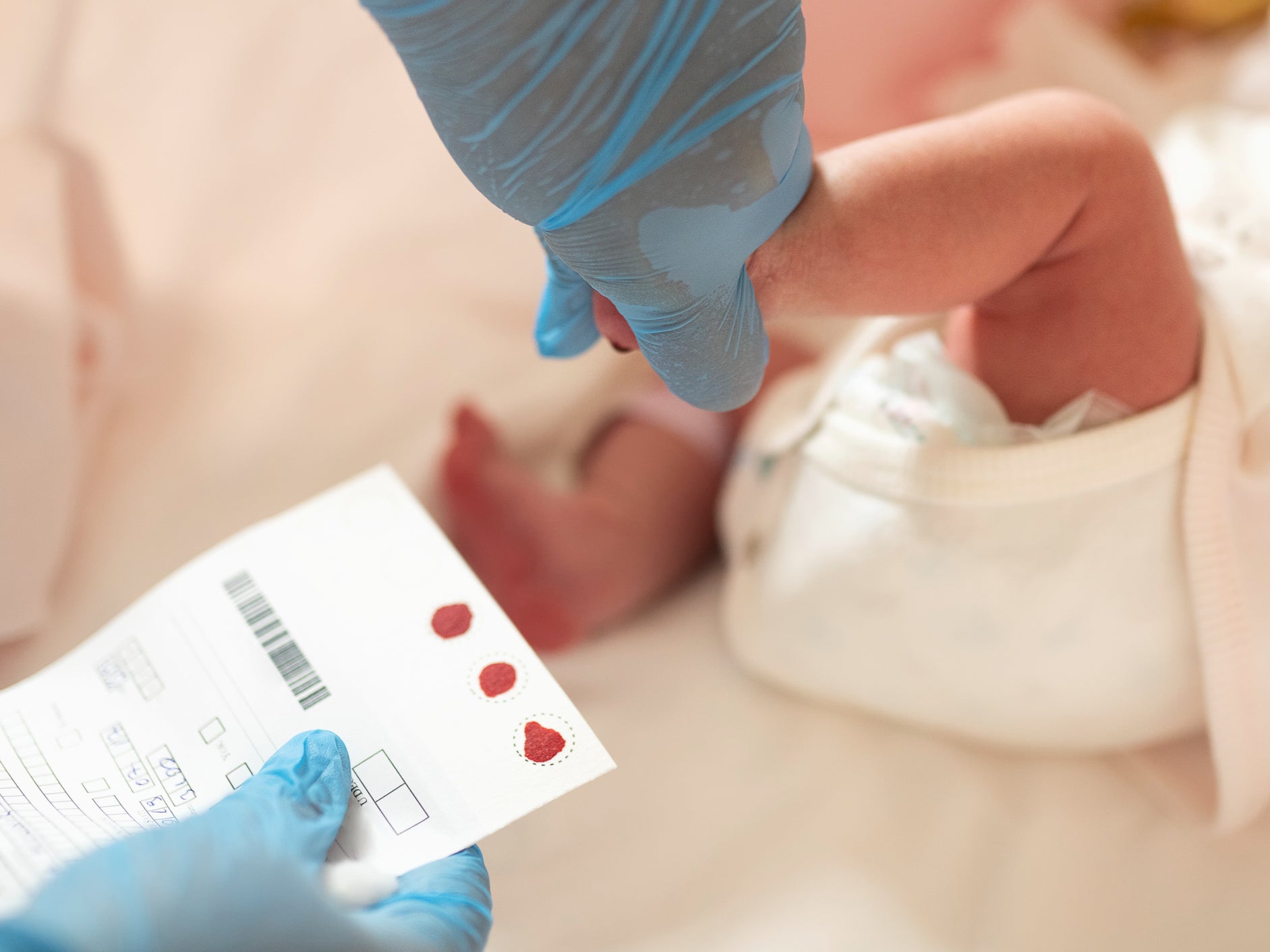 Drops of blood from a baby’s heel are dropped onto paper for genetic disease screening