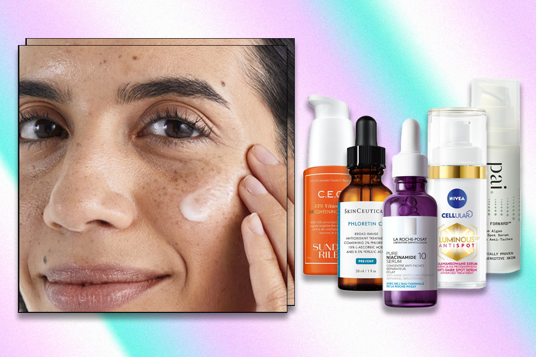 Common types of pigmentation are melasma, post-acne marks and solar lentigines from UV exposure