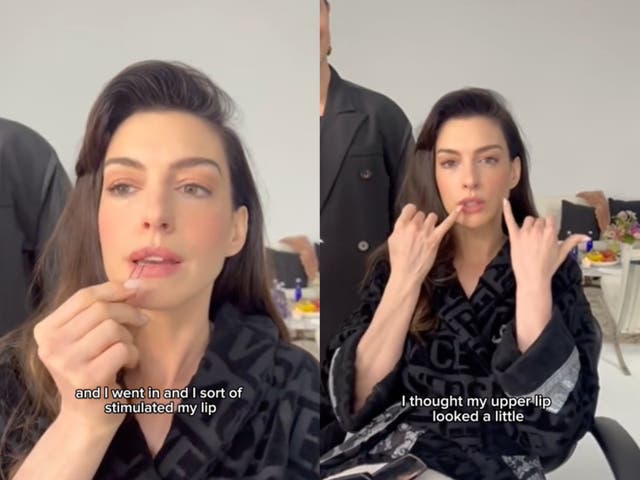 <p>Anne Hathaway’s savvy use of hair pins to plump lips goes viral</p>