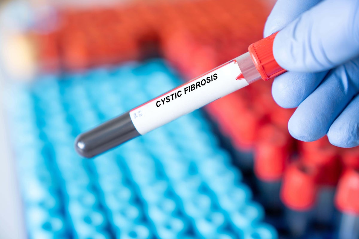 ‘Life-changing’ therapy now available for cystic fibrosis patients