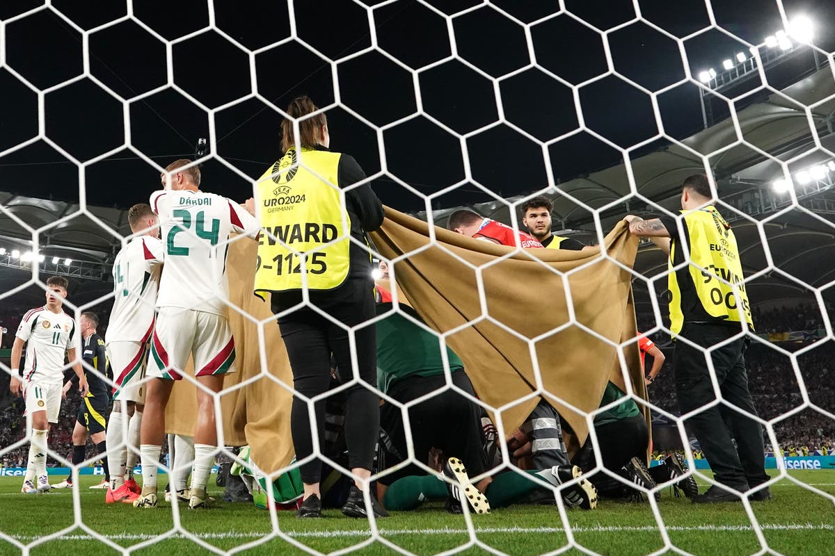 Hungary striker Barnabas Varga broke several facial bones against Scotland