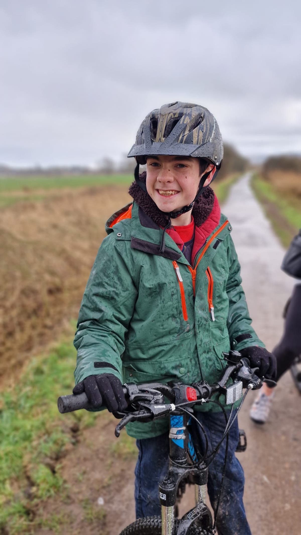 First child to have epilepsy device fitted in his brain has huge reduction ...