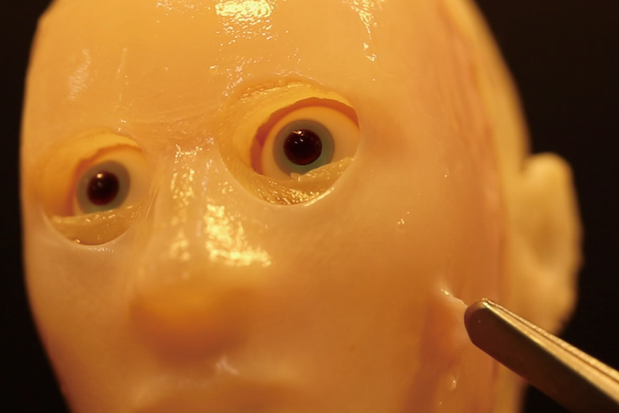 A 3D facial mould covered with living human skin