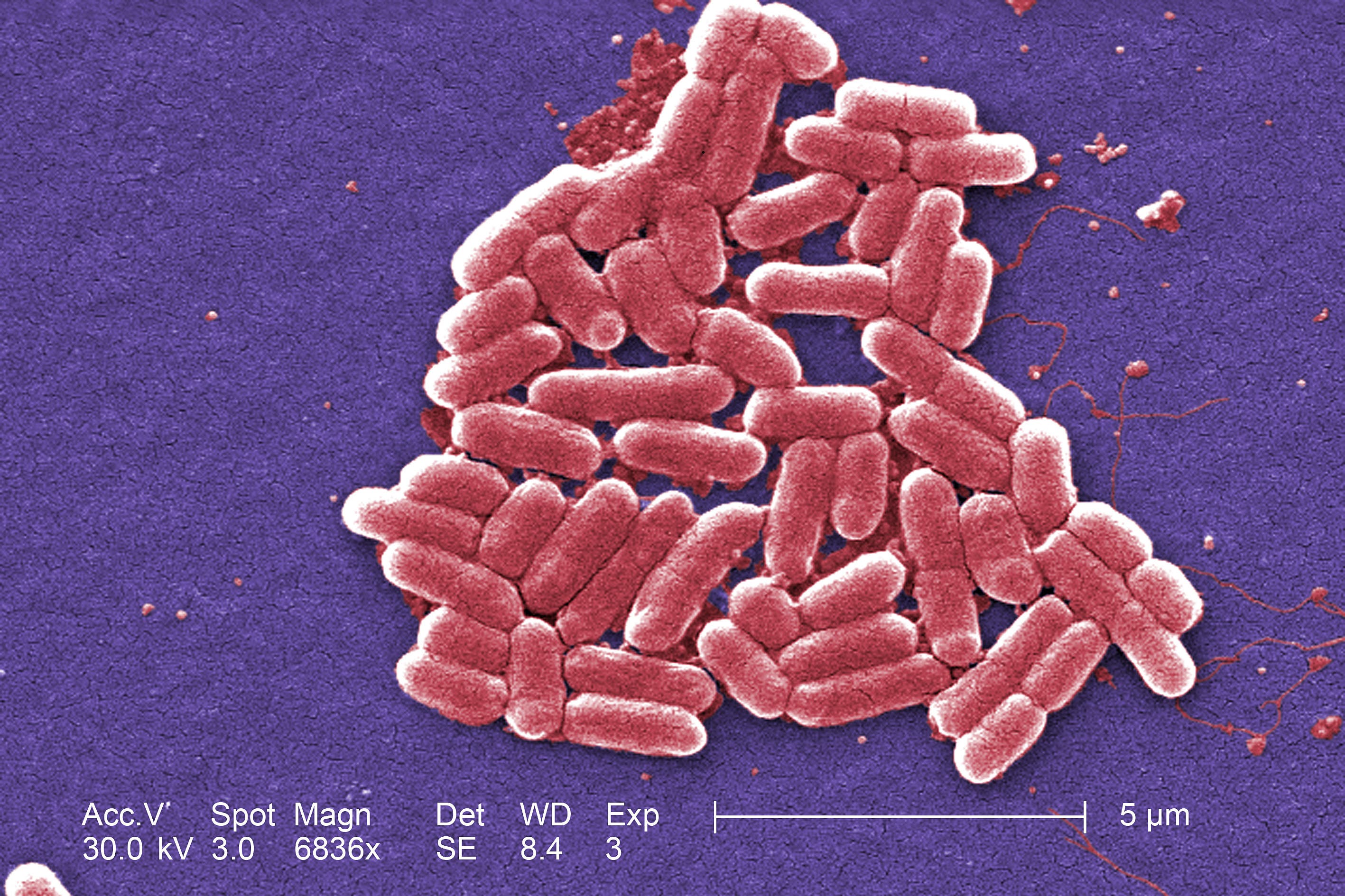 E.Coli bacteria (Centers for Disease Control and Prevention/PA)