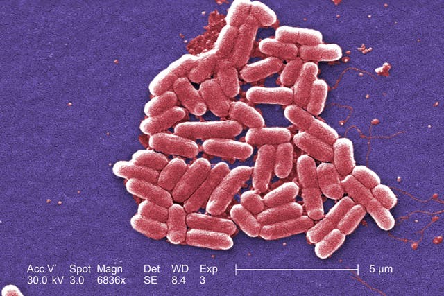 <p>E.Coli bacteria (Centers for Disease Control and Prevention/PA)</p>