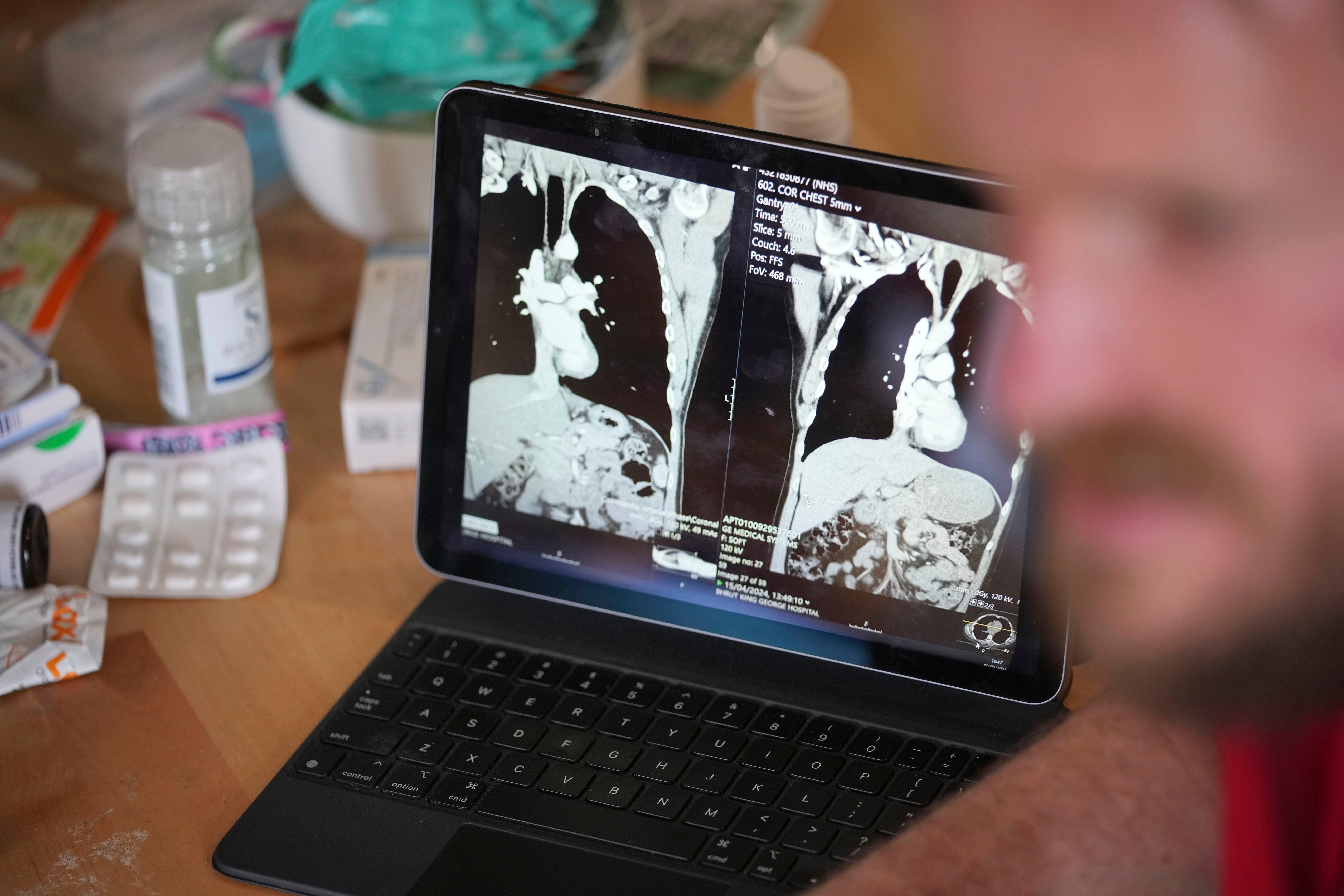 Britain Election NHS in Crisis