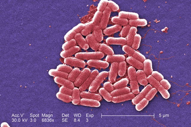 Investigators believe the E coli outbreak is linked to salad used in sandwiches (Centres for Disease Control and Prevention/PA)