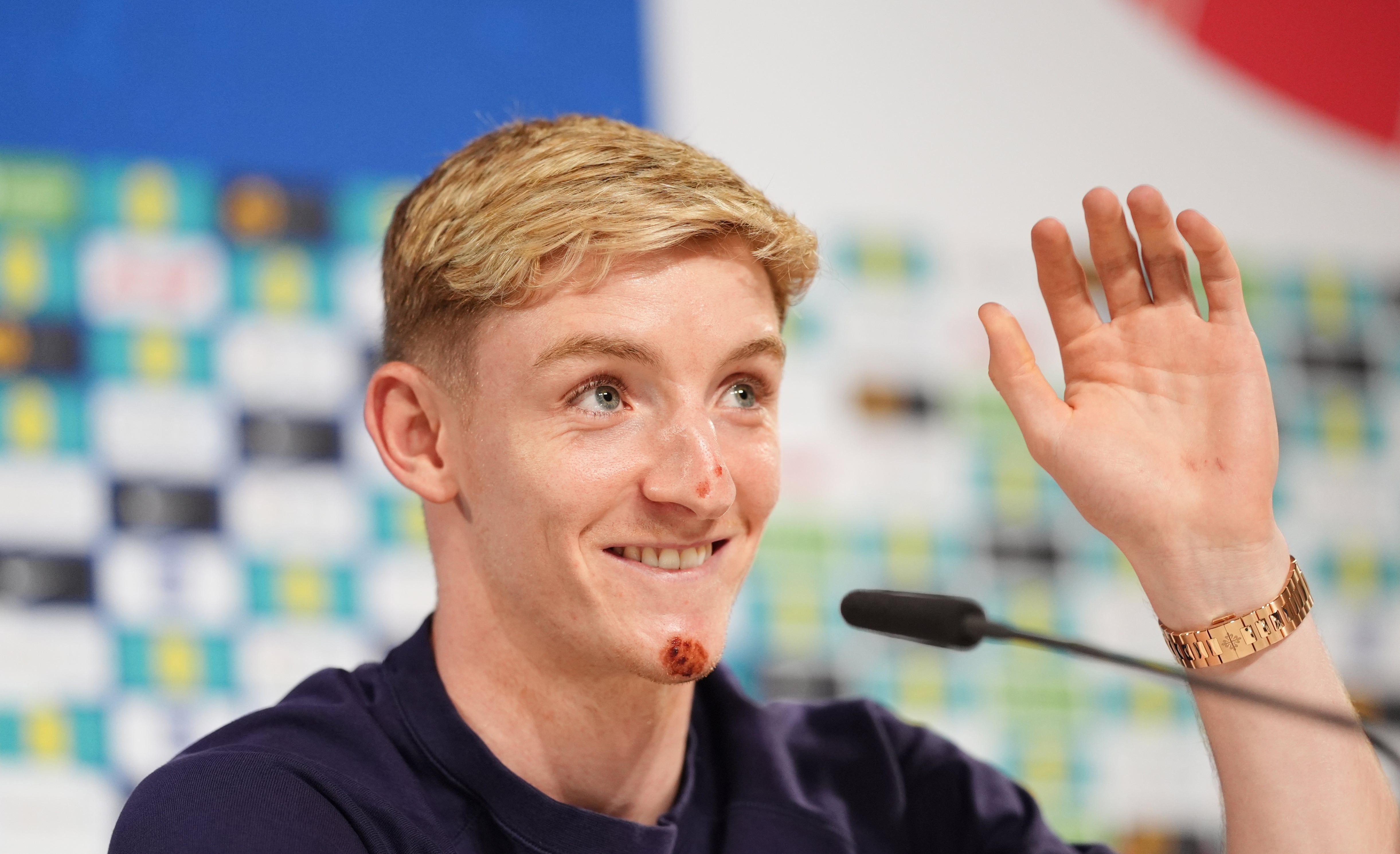 England’s Anthony Gordon explains his bike accident during a press conference (Adam Davy/PA)