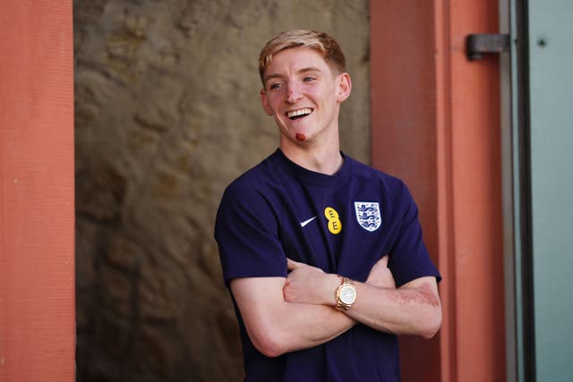 <p>England’s Anthony Gordon poses after press conference at the England training base at Euro 2024. (Adam Davy/PA)</p>